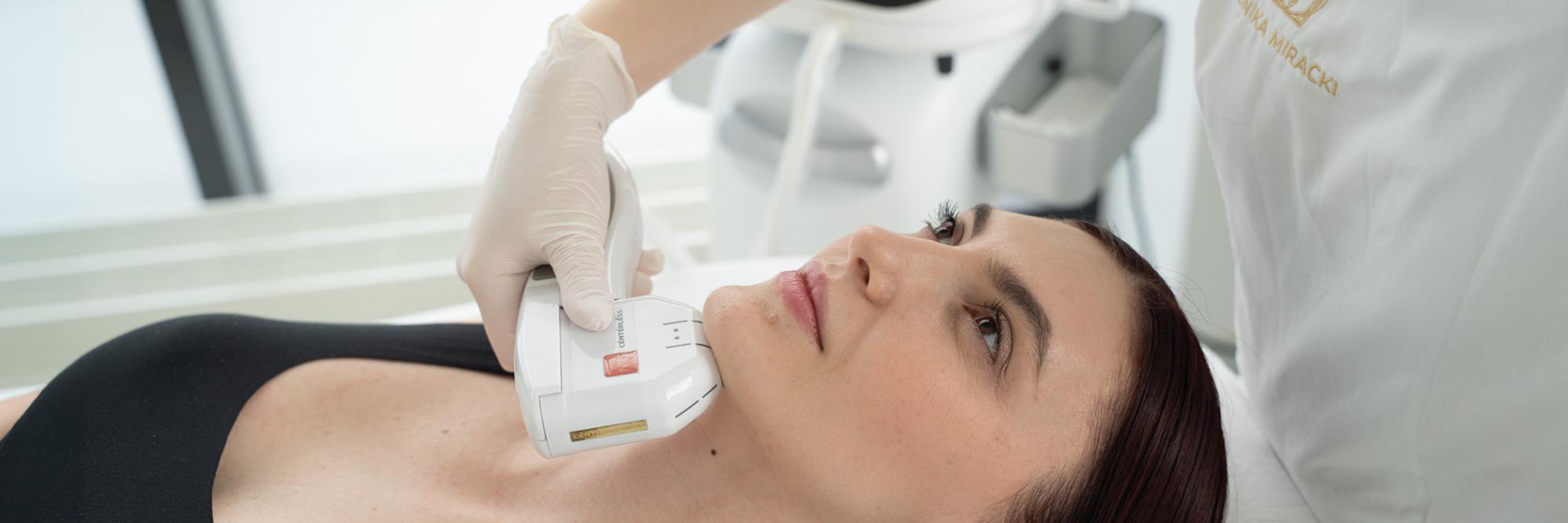 HIFU – Lifting bez skalpela