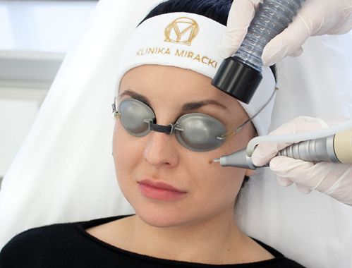 Masz na ciele znamiona, których chcesz się pozbyć? Przyjdź na laserowe usuwanie pieprzyków do Kliniki Miracki w Katowicach!