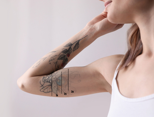 Zastanawiasz się jak działa laserowe usuwanie tatuażu? ✹ Sprawdź porady naszych ekspertów z kliniki w Katowicach, Krakowie, Łodzi czy Warszawie i zapisz się na zabieg!