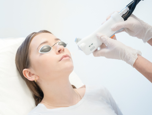 Masz na skórze zmiany naczyniowe, których chcesz się pozbyć? Przyjdź do Kliniki Miracki w Warszawie!