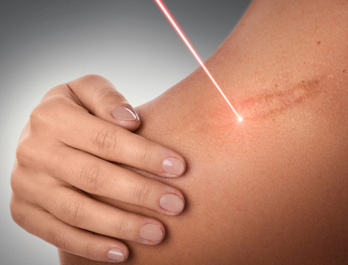 Zapraszamy na zabiegi w naszych klinikach w Warszawie, Katowicach, Łodzi i Krakowie.