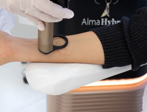 Zapraszamy na zabiegi w naszych klinikach w Warszawie, Katowicach, Łodzi i Krakowie.