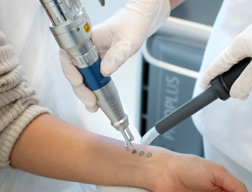 Lekarze z naszej kliniki w Katowicach ujawniają czy po laserowym usuwaniu tatuażu zostaje blizna. Dowiedz się więcej. Zapraszamy też na zabiegi w naszych klinikach w Warszawie, Łodzi i Krakowie.