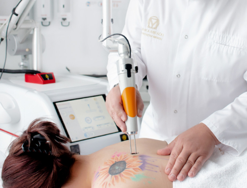Masz na ciele tatuaż lub makijaż permanentny, którego chcesz się pozbyć? Przyjdź do Kliniki Miracki na profesjonalna laseroterapię!