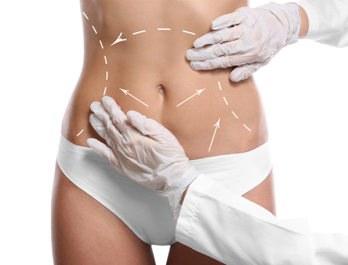 Ile kosztuje Lipotransfer w Warszawie?