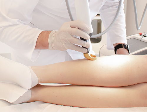 Ile kosztuje laserowe usuwanie pajączków w Łodzi?