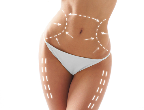 Jak długo utrzymuje się efekt kriolipolizy? Zabieg dostępny niebawem w naszej klinice w Krakowie. Zapraszamy na zabiegi modelujące do naszych klinik w Warszawie, Katowicach i Łodzi.