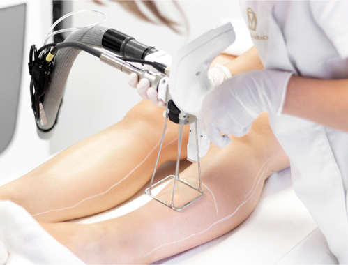 Chcesz trwale pozbyć się niechcianych włosków na nogach? Przyjdź do Kliniki Miracki w Krakowie na laserową depilację!