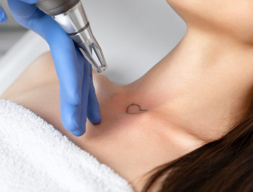 Zastanawiasz się czy usuwanie tatuażu laserem jest bezpieczne? ✹ Sprawdź porady naszych ekspertów z kliniki w Katowicach, Krakowie, Łodzi i Warszawie i zapisz się na zabieg!