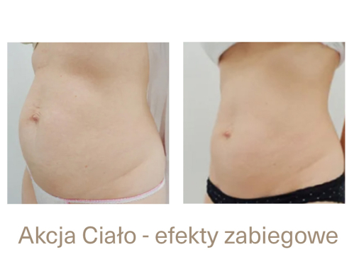 Akcja Ciało dobiega końca! Ostatni moment, aby skorzystać z najlepszych cen