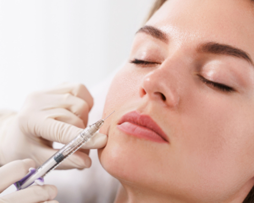 Na czym polega wypełnianie zmarszczek?