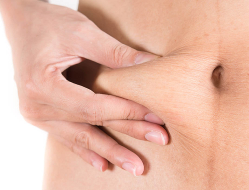 Wiotka skóra na udach to przypadłość, pojawiająca się wraz z wiekiem lub pod wpływem utraty masy ciała. ✹ Poznaj sprawdzone zabiegi ujędrniające w Klinice w Warszawie i Katowicach. Zapraszamy także na zabiegi do naszych klinik w Krakowie i Łodzi.