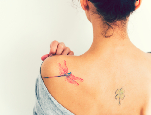 Laserowe usunięcie tatuażu to bezpieczny i szybki zabieg. Czy zawsze można go wykonać? Laser a tatuaż ♦ Klinika Miracki Warszawa, Katowice, Kraków, Łódź.