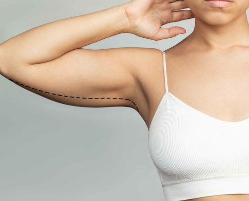 Masz kompleks związany z obwisłą skórą na ramionach? ✹ Odkryj, jak ujędrnić obwisłe ramiona z pomocą zabiegów dostępnych w Klinice w Warszawie lub Katowicach. Zapraszamy na zabiegi też do naszych klinik w Krakowie i Łodzi.