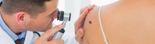 Zmiany skórne pod lupą! Trzy technologie usuwania zmian skórnych w Klinice Miracki. Gwarancja skuteczności i bezpieczeństwa. Super efekty i ceny zabiegów. → Warszawa, Katowice, Kraków, Łódź.