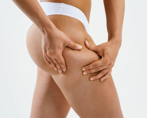 Jaki masaż antycellulitowy jest najskuteczniejszy?