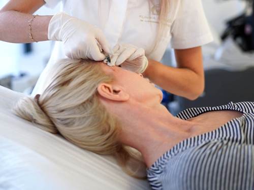 Kwas polimlekowy jest jednym z popularniejszych biostymulatorów w medycynie estetycznej. Zobacz, jak działa i jakie efekty przynosi zabieg!