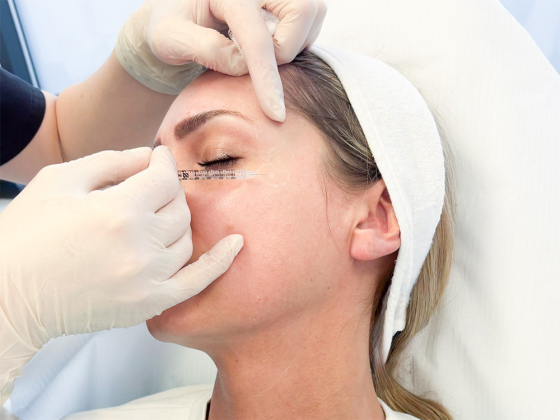 Płynny preparat PEARL Technology to przełom w redukcji zmarszczek mimicznych - daje efekty już od 1 dnia. Zobacz efekty naszych Pacjentek!