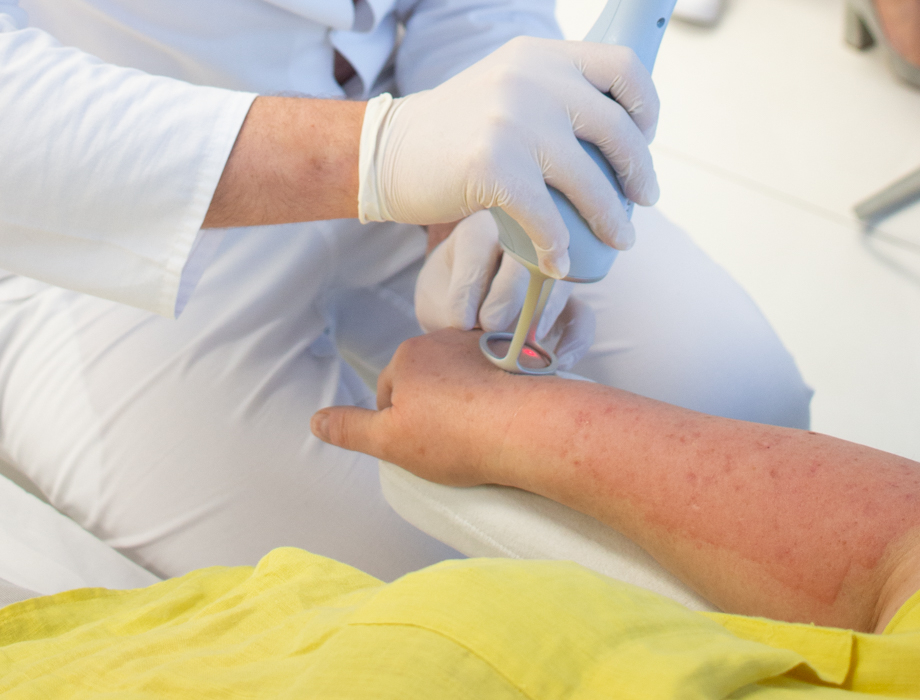 Cierpisz na otyłość i z tego powodu masz zmiany skórne? Usuń je w Klinice Miracki w Katowicach!