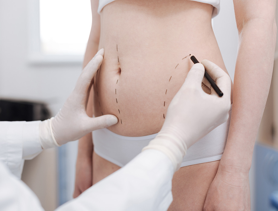 Ile kosztuje liposukcja w Warszawie?