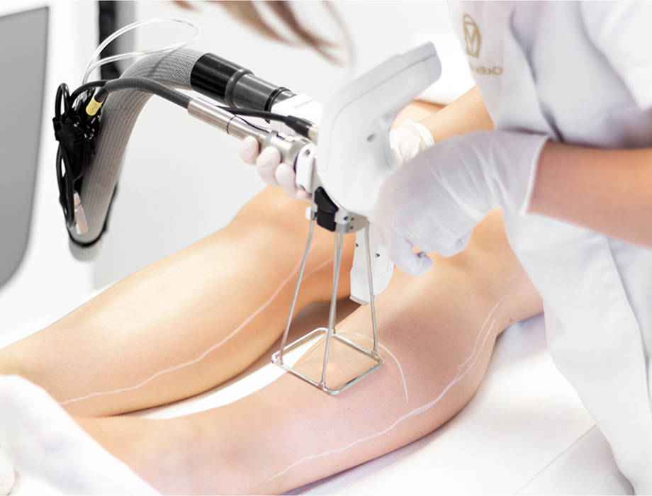 Chcesz trwale pozbyć się niechcianych włosków na nogach? Przyjdź do Kliniki Miracki w Krakowie na laserową depilację!