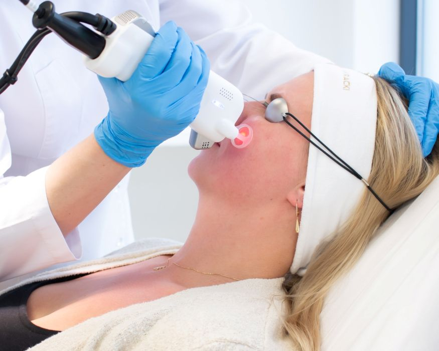 Czerwona na twarzy? Sprawdź przegląd zabiegów na rumień i pękające naczynka