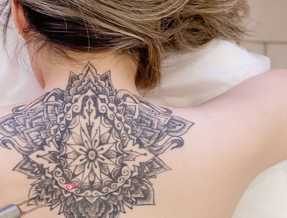 Zastanawiasz się na czym polega usuwanie tatuażu? ✹ Sprawdź porady naszych ekspertów z kliniki w Katowicach, Warszawie, Łodzi i Krakowie i zapisz się na zabieg!