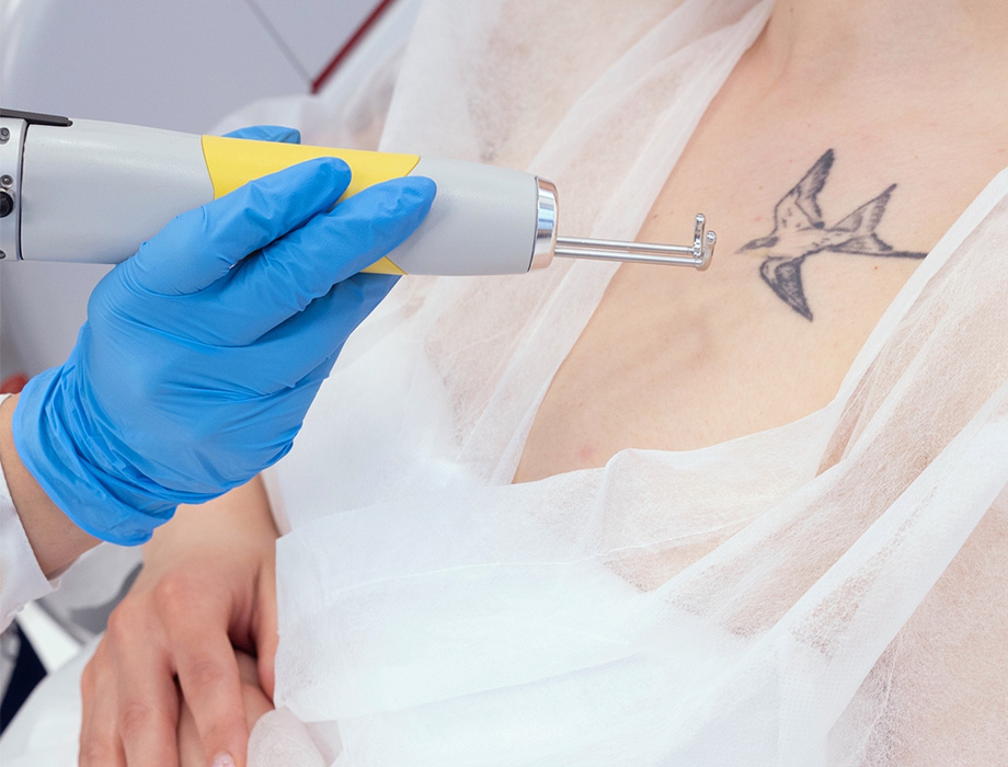 Zastanawiasz się, ile kosztuje usunięcie tatuażu w Krakowie? Zapisz się na konsultację w naszej krakowskiej klinice.