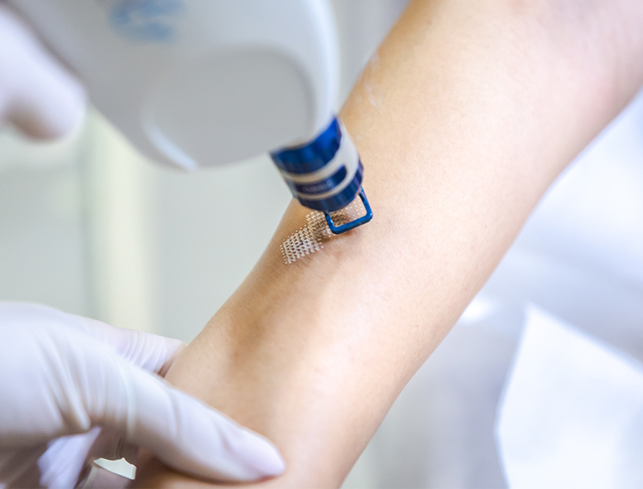 Ile kosztuje zabieg usunięcia blizny w Katowicach?