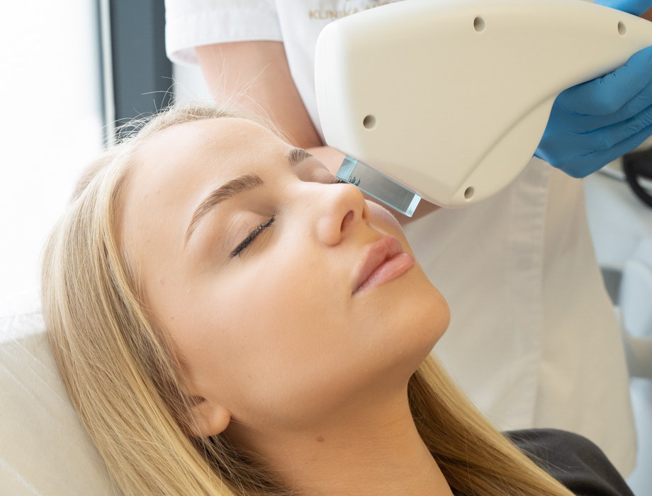 Laserowe usuwanie pajączków to jedna z najskuteczniejszych metod redukcji rozszerzonych naczynek. Sprawdź, ile kosztuje zabieg na pajączki.