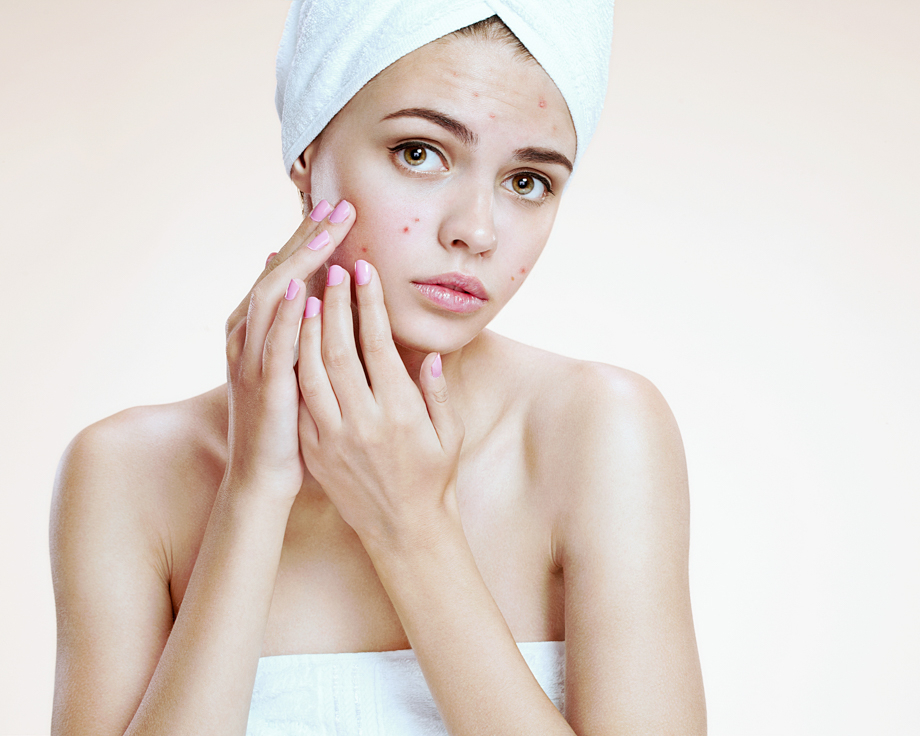 Jak wyleczyć trądzik krostkowy?