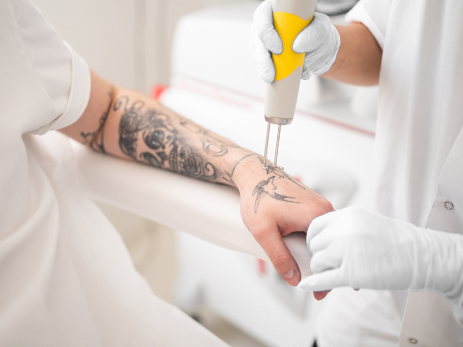 Dzięki Laseroterapii pozbędziesz się każdego koloru tatuażu. Sprawdź, dlaczego warto wybrać zabieg Laserem Pikosekundowym!