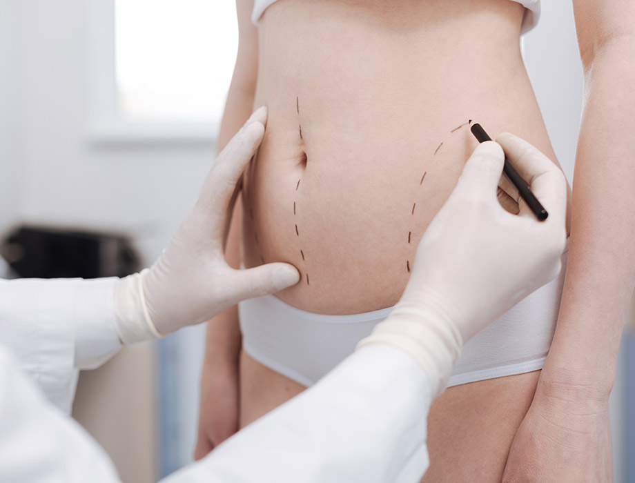 Liposukcja i lipoliza to dwa zabiegi w Klinice Miracki w Katowicach, które umożliwiają spektakularną redukcję tkanki tłuszczowej. ✹ Zapraszamy też do naszych klinik w Warszawie, Łodzi i Krakowie.