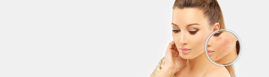 Dzięki zabiegom laserowym, możliwe jest pozbycie się blizn różnego pochodzenia. → Nie czekaj, zapisz się na terapię w warszawskiej, łódzkiej, krakowskiej lub katowickiej Klinice Miracki.