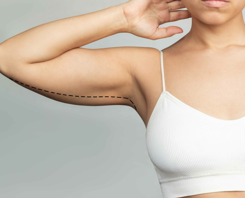 Masz kompleks związany z obwisłą skórą na ramionach? ✹ Odkryj, jak ujędrnić obwisłe ramiona z pomocą zabiegów dostępnych w Klinice w Warszawie lub Katowicach. Zapraszamy na zabiegi też do naszych klinik w Krakowie i Łodzi.