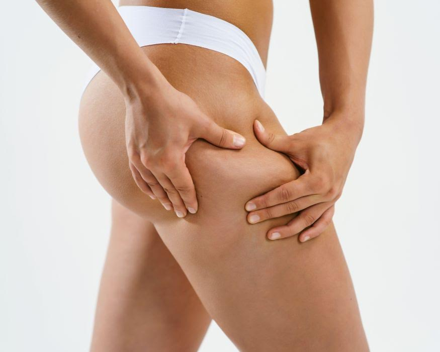 Jaki masaż antycellulitowy jest najskuteczniejszy?