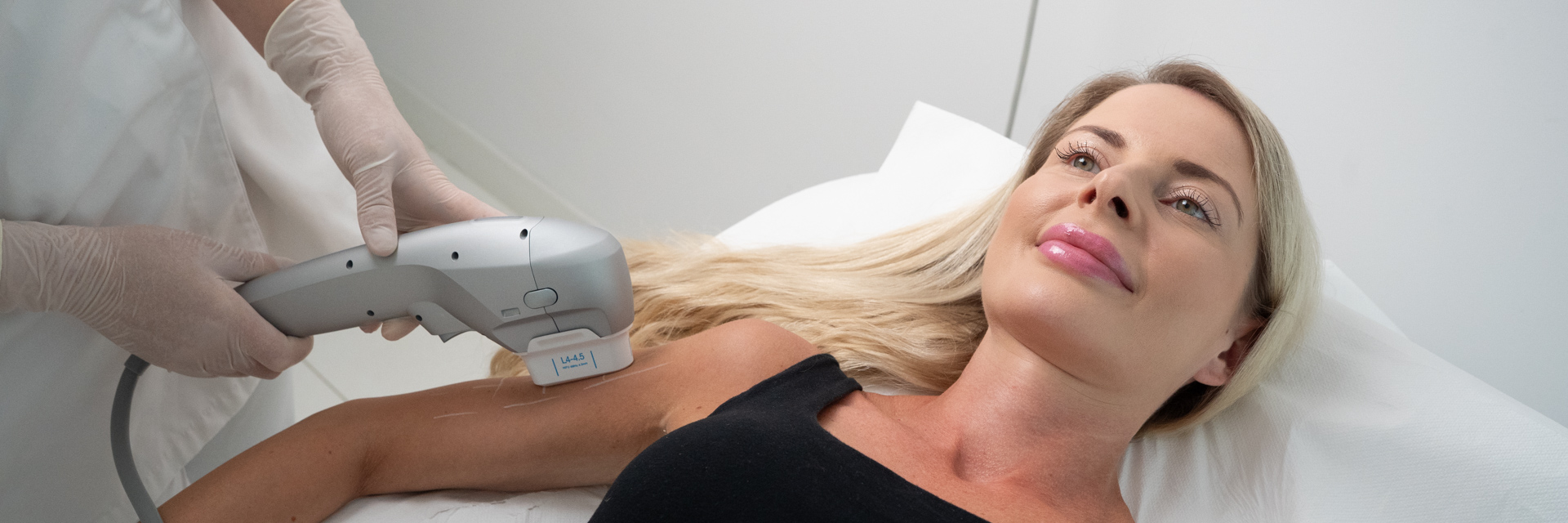 HIFU – Lifting bez skalpela