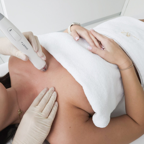 Virtue RF – Redukcja blizn