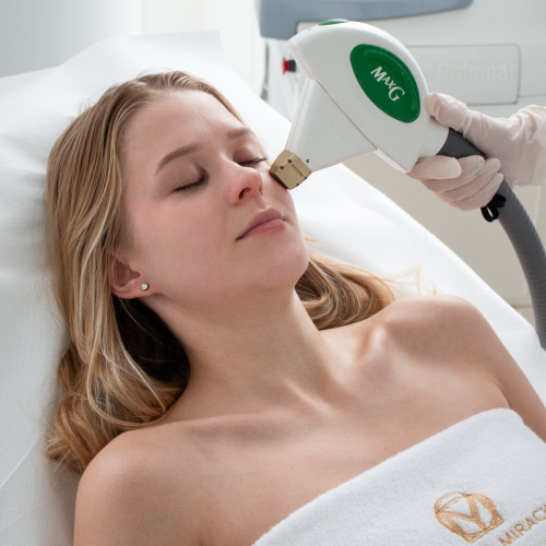 Icon Cynosure MaxG – Laserowe Odmładzanie