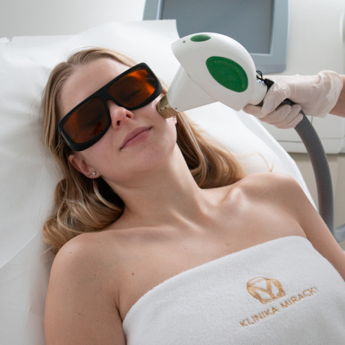 Icon Cynosure MaxG – Laserowe leczenie zmian naczyniowych