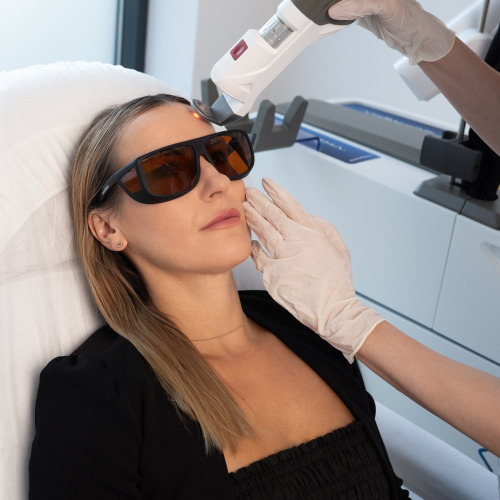 Suprema Quanta – Laserowe Odmładzanie