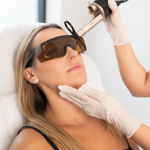 Hybrid Alma – Laserowe Odmładzanie