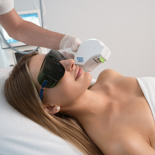 BBL HEROic – Laserowe leczenie zmian naczyniowych