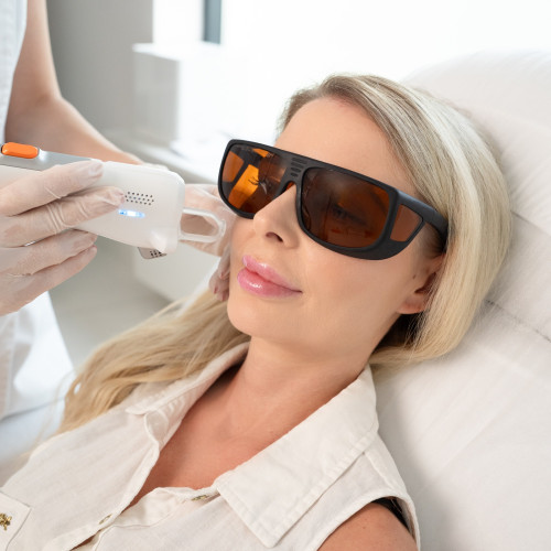 Derma V Lutronic – Laserowe leczenie zmian naczyniowych