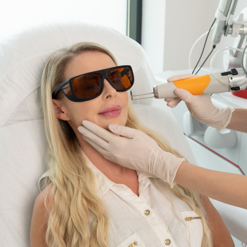 Discovery Pico Plus Quanta – Laserowe leczenie przebarwień