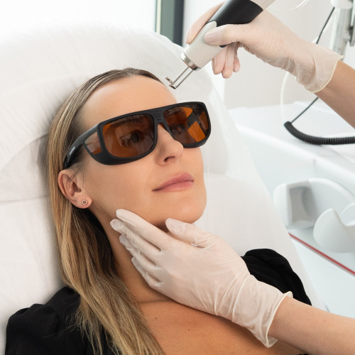 Discovery Pico Plus Quanta – Laserowe Odmładzanie