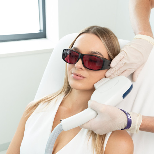 Harmony Alma Acne – Laserowe leczenie trądziku pospolitego