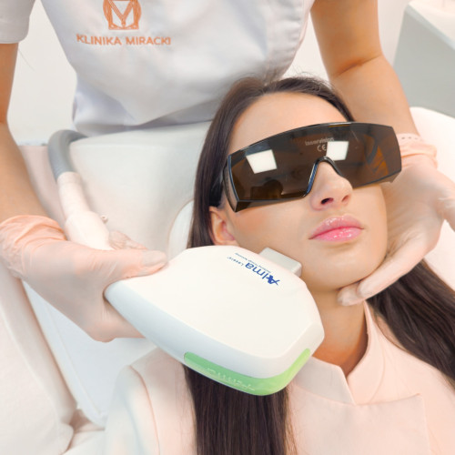 Harmony Alma DYE-VL – Laserowe Odmładzanie