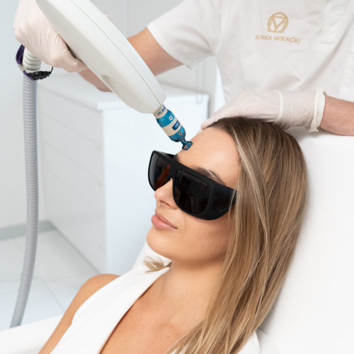 Harmony Alma iPixel – Laserowe Odmładzanie