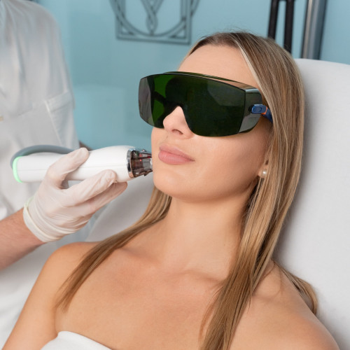 Laser Tulowy MOXI – Laserowe Odmładzanie